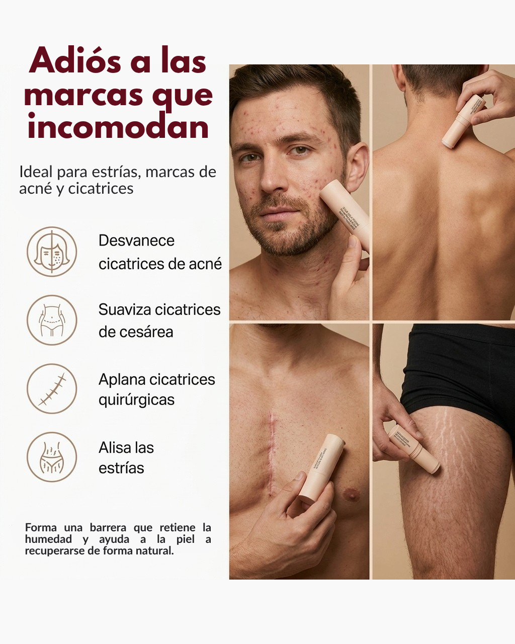 Cicatrizante en barra - Elimina cicatrices, estrías y marcas de acné