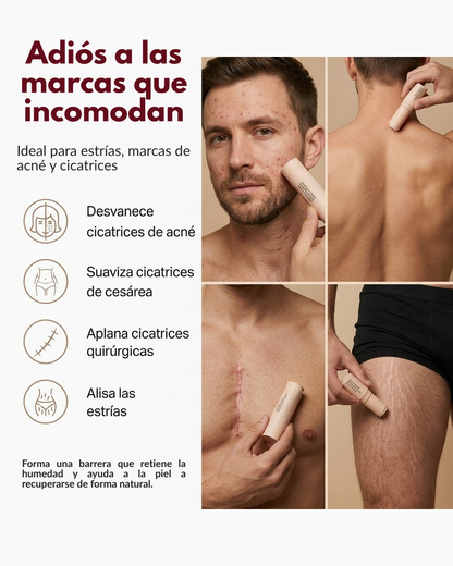 Cicatrizante en barra - Elimina cicatrices, estrías y marcas de acné