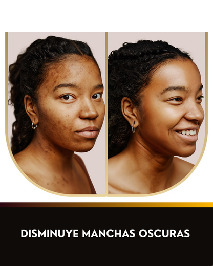Jabón Despigmentante Con Ácido Kójico, Cúrcuma y Retinol